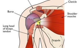 Rotator Cuff Pain Relief